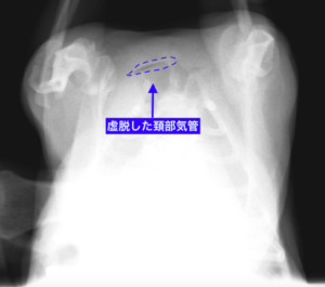 虚脱した頚部気管